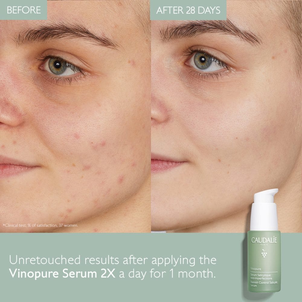 caudalie-vinopure-blemish-control-salicylic-serum-3